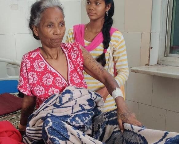 उपमुख्य विजय शर्मा के प्रयासों से बुजुर्ग महिला को मिला जीवनदान, महिला बच्चेदानी से 12 किलोग्राम का मल्टीपल ओवेरियन सिस्ट (गांठ) का हुआ सफल ऑपरेशन