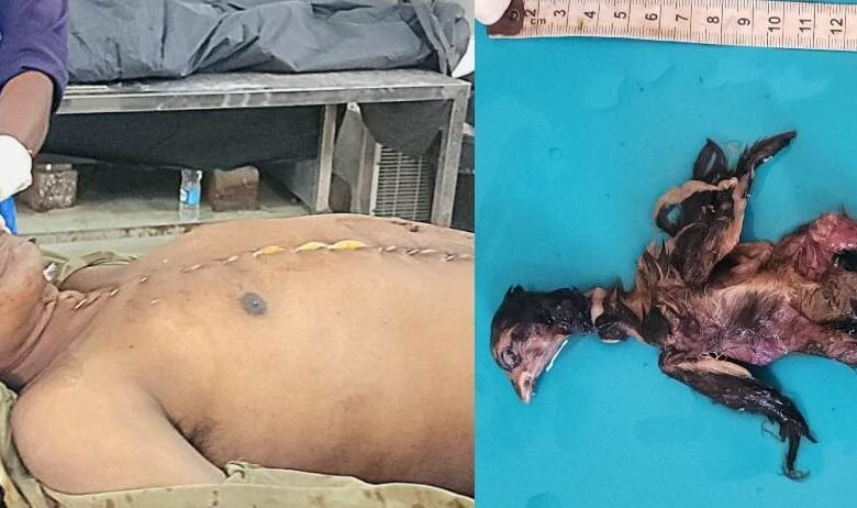 अंधविश्वास का खौफनाक अंजाम: तांत्रिक के कहने पर युवक ने निगला जिंदा चूजा, फिर जो हुआ वो सबको था चौंका देने वाला! पढ़ें पूरी खबर