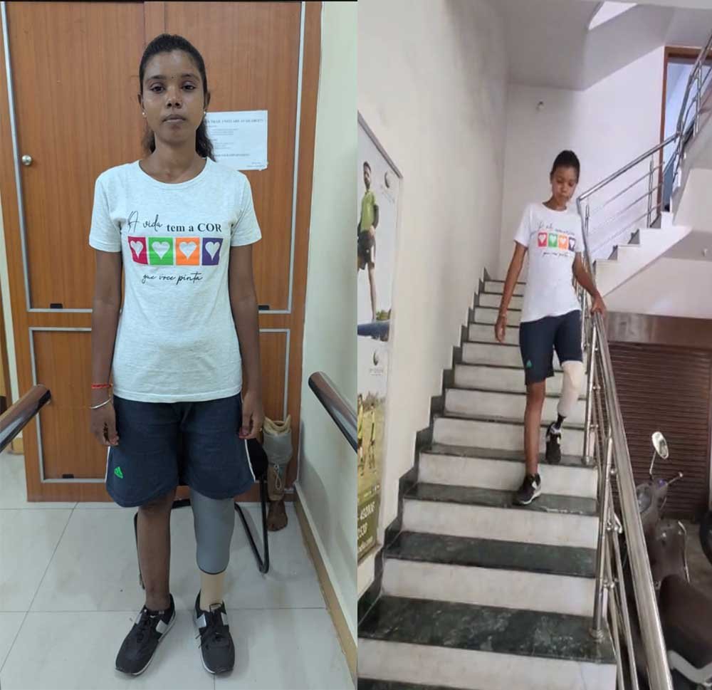 अब आत्मविश्वास के साथ सामान्य जीवन जी रहीं बबीता यादव, शासन-प्रशासन के प्रति जताया आभार 1 Divya 01 1