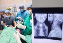 Docter 0