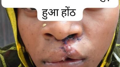 स्वास्थ्य सेवाओं की सफलता, सफल ऑपरेशन के बाद भीमे हेमला फिर मुस्कुराए 2 saflta 01 5