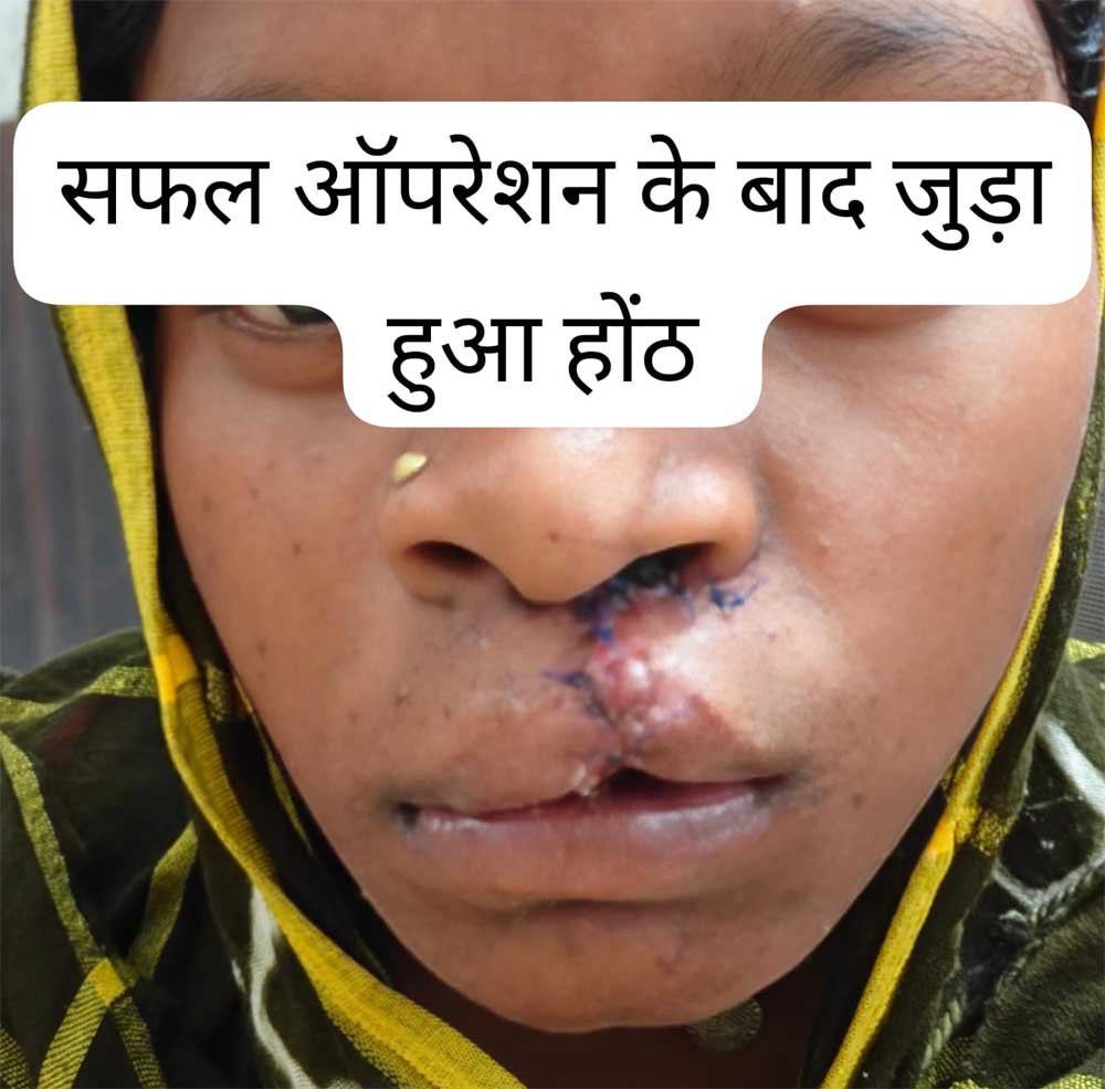 स्वास्थ्य सेवाओं की सफलता, सफल ऑपरेशन के बाद भीमे हेमला फिर मुस्कुराए 1 saflta 01 5
